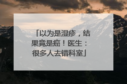 以为是湿疹，结果竟是癌！医生：很多人去错科室