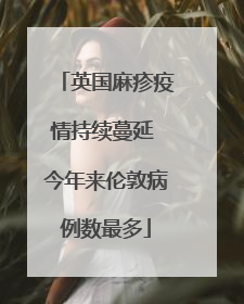 英国麻疹疫情持续蔓延 今年来伦敦病例数最多